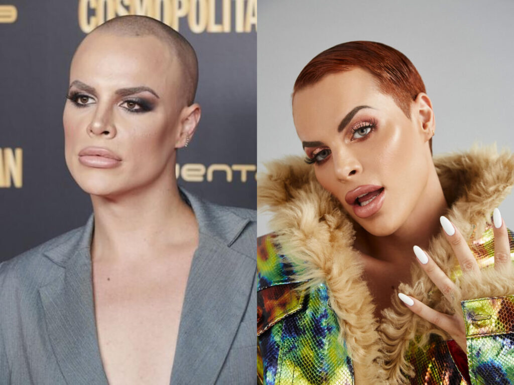 jedet antes y despues