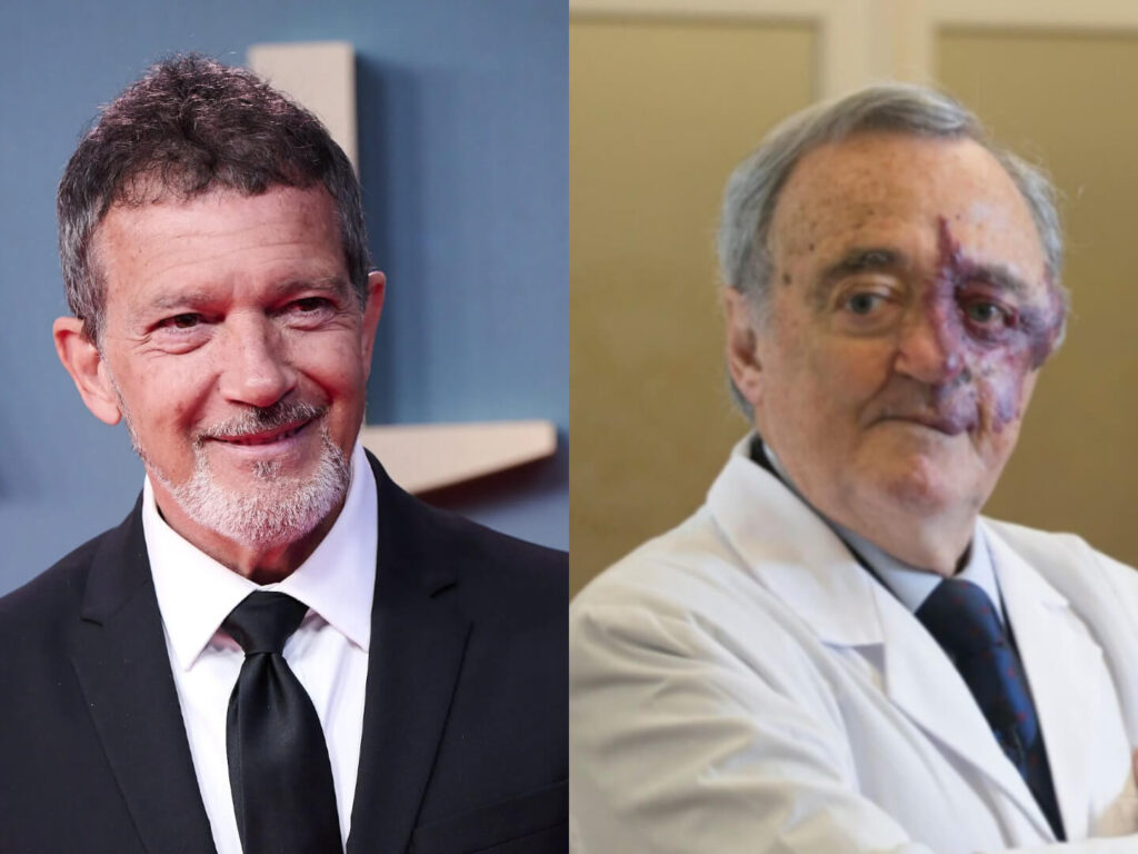 antonio banderas cancer